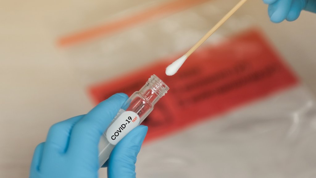 Результаты тестов на COVID-19 теперь будут доступны на едином портале госуслуг