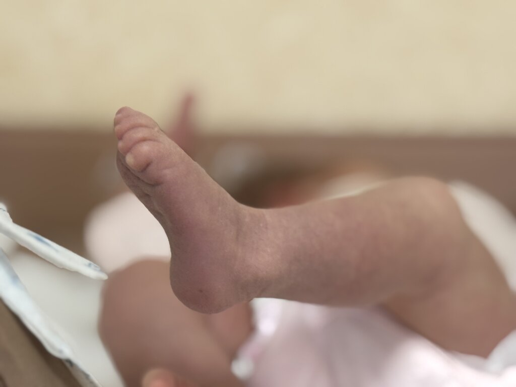 Утвержден порядок возмещения расходов на дополнительные процедуры при направлении на ЭКО